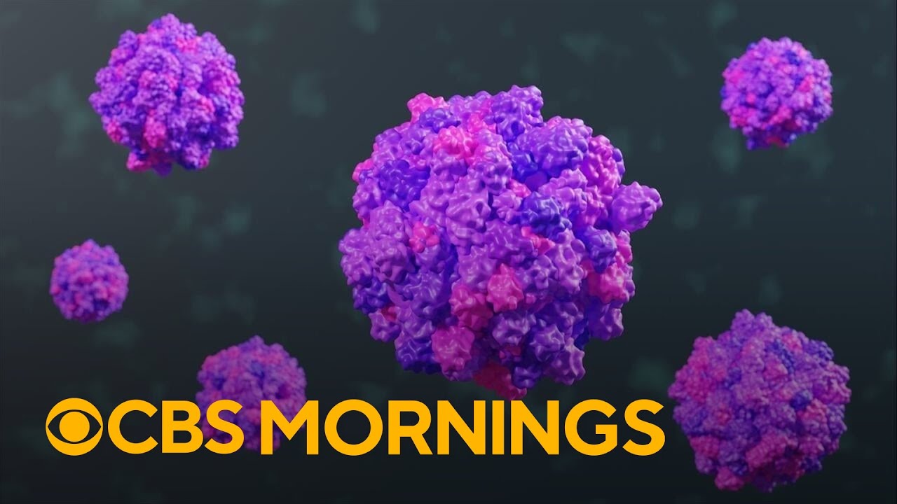 Highly contagious norovirus spreading across the U.S. ahead of holidays Vlog Highly contagious norovirus spreading across the U.S. ahead of holidays Vlog